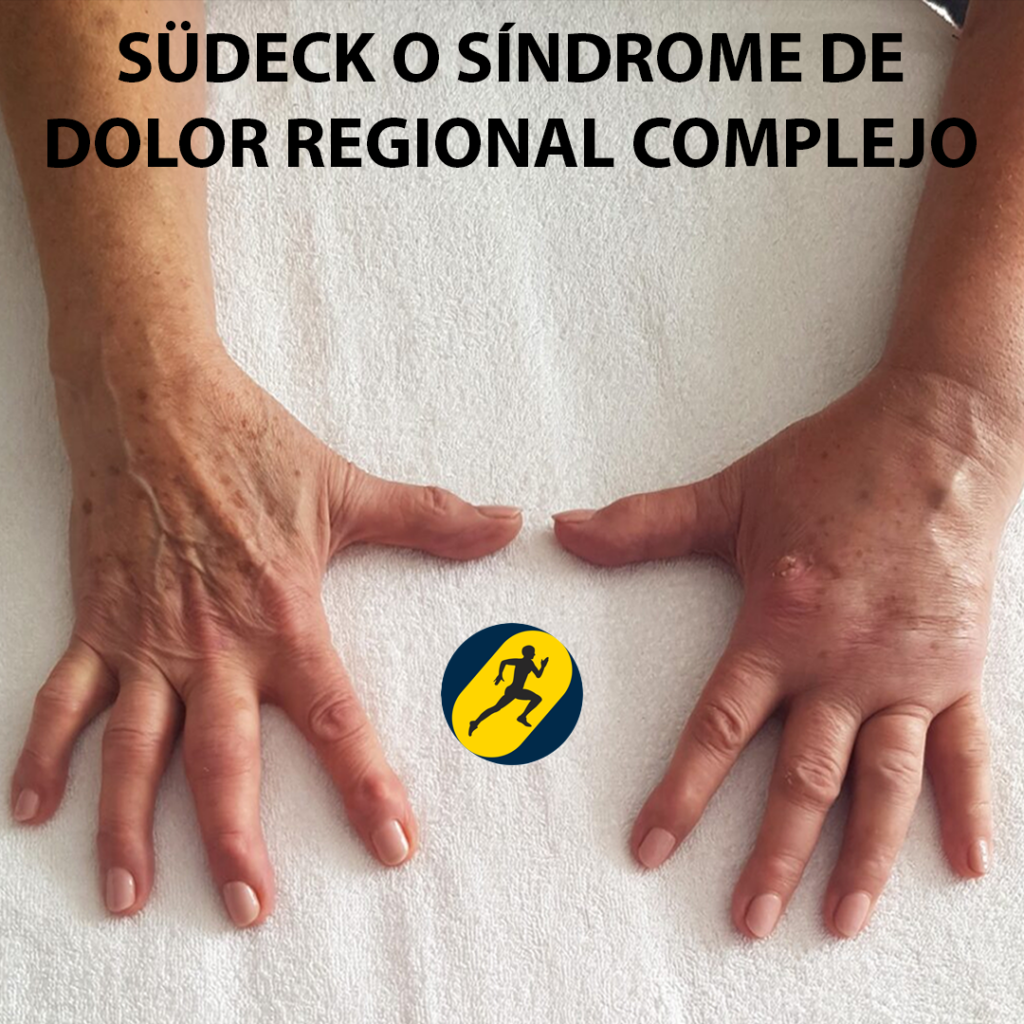 Portada Sudeck